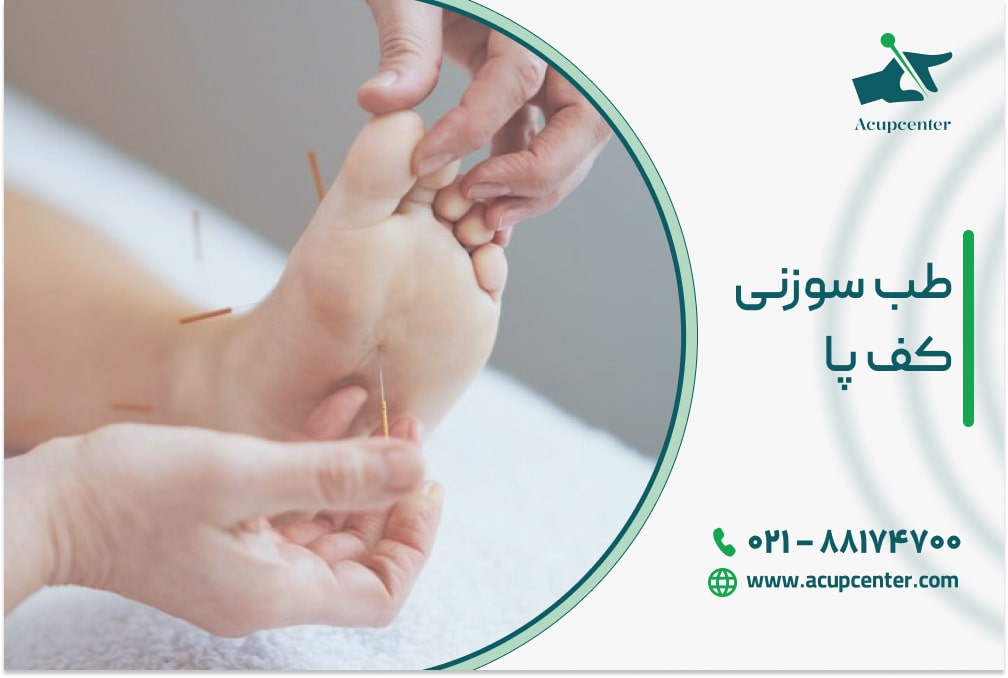 طب سوزنی کف پا