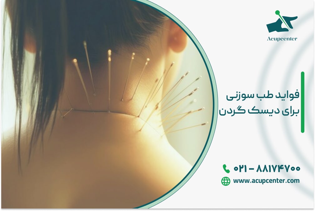 فواید طب سوزنی برای دیسک گردن