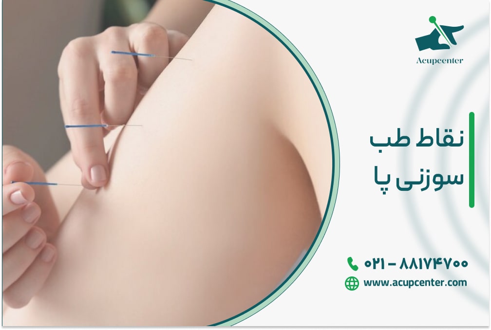 نقاط طب سوزنی پا