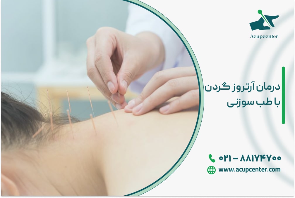 درمان آرتروز گردن با طب سوزنی
