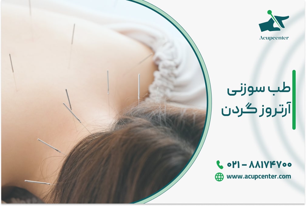 طب سوزنی آرتروز گردن
