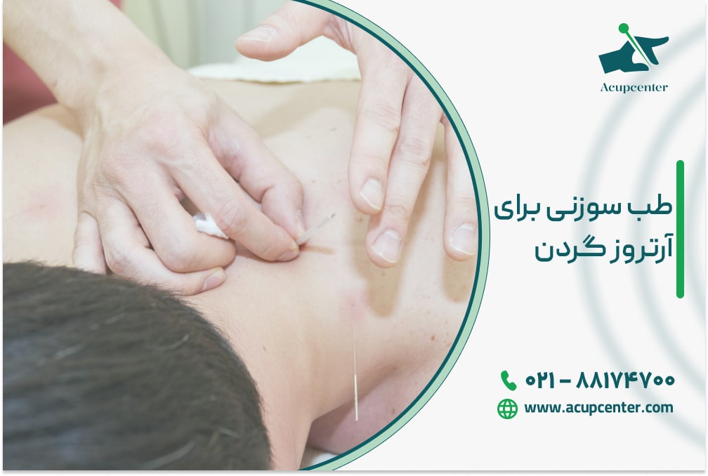 طب سوزنی برای آرتروز گردن